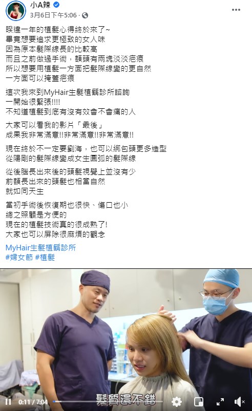 密集恐懼症慎入!小A辣「植髮」滿一年成果曝光：還蠻喜歡的 - Yummyday美味日子